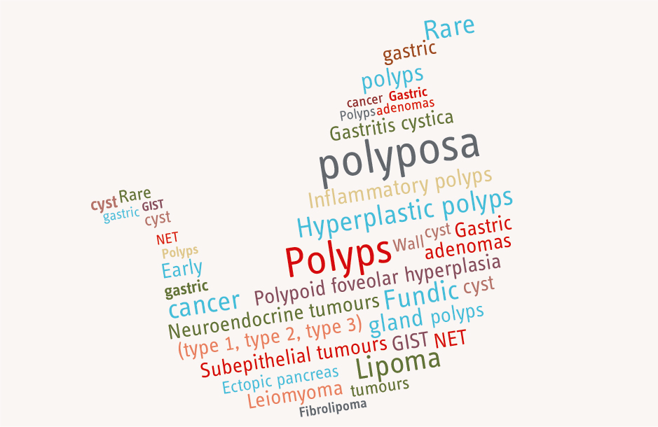 Gastric polyps