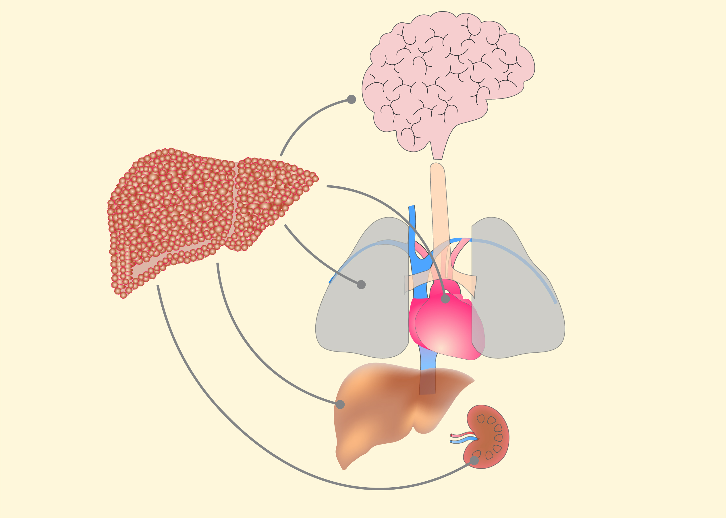 Acute-on-Chronic Liver Failure