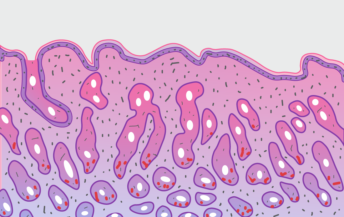 The diagnosis and management of coeliac disease and gluten-related disorders