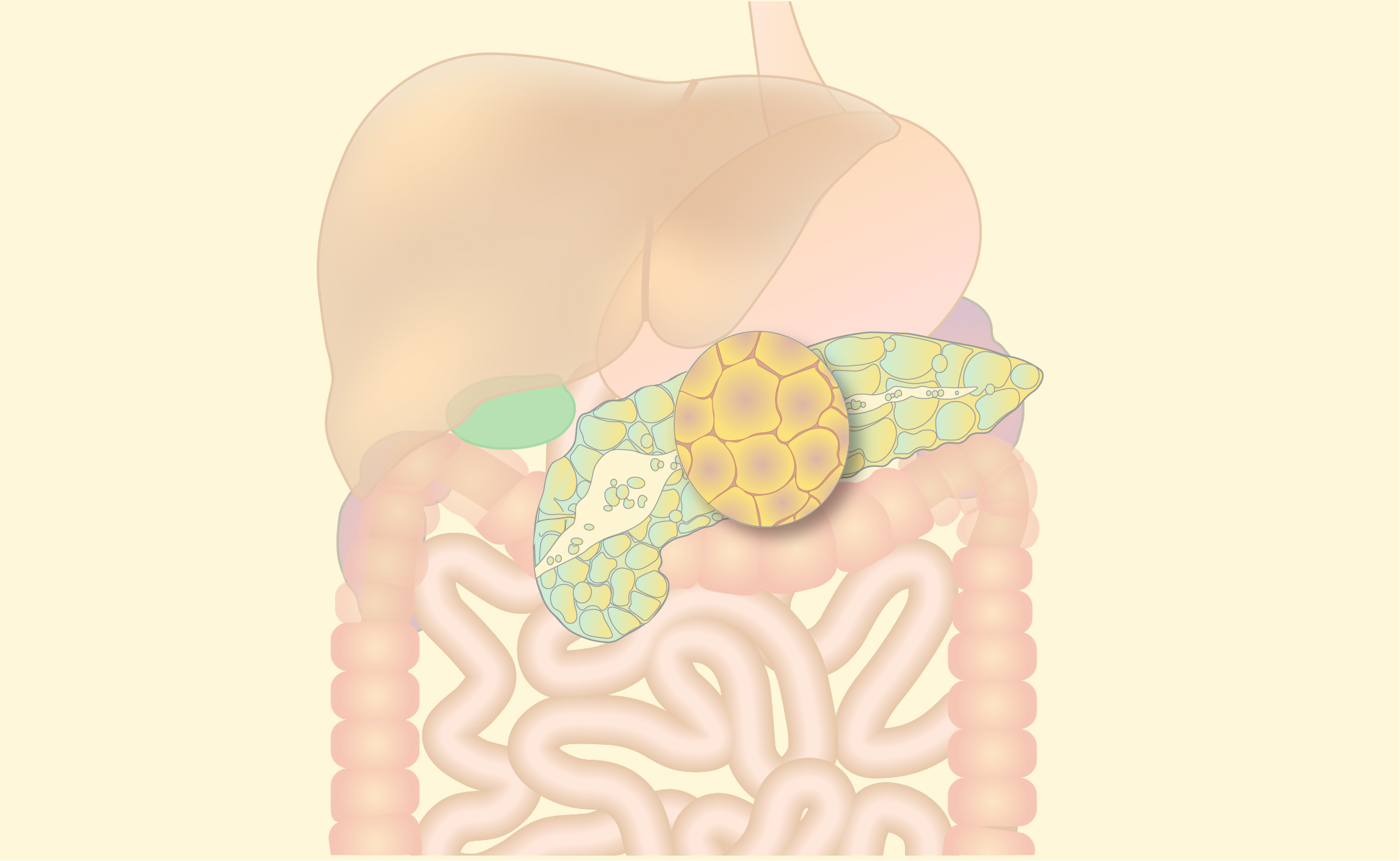 Pancreatic cancer - Part 1